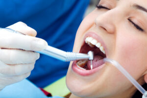 caries dentales