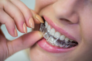 brackets invisibles